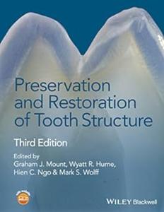Preservation and Restoration of Tooth Structure (2024)