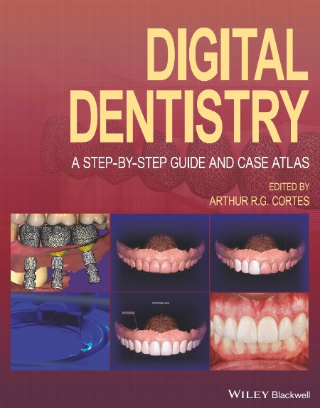 Digital Dentistry by Arthur R. G. Cortes 09bab1568630fbcc238f70a04131c212