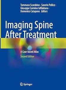 Imaging Spine After Treatment (2nd Edition)