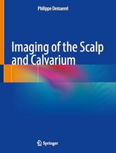 Imaging of the Scalp and Calvarium