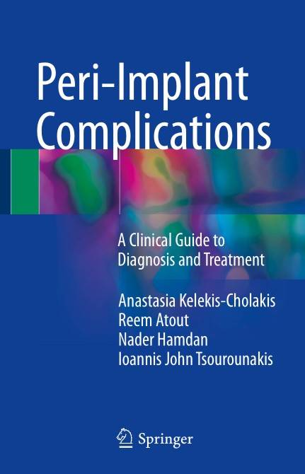 Peri-Implant Complications A Clinical Guide to Diagnosis and Treatment (2024)