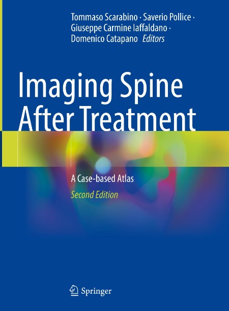 Imaging Spine After Treatment by Tommaso Scarabino 0196af2dabcfb8773c3ccb0ec53af76b