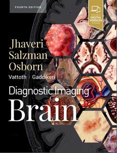 Diagnostic Imaging Brain (4th Edition)