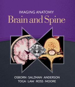 Imaging Anatomy Brain and Spine